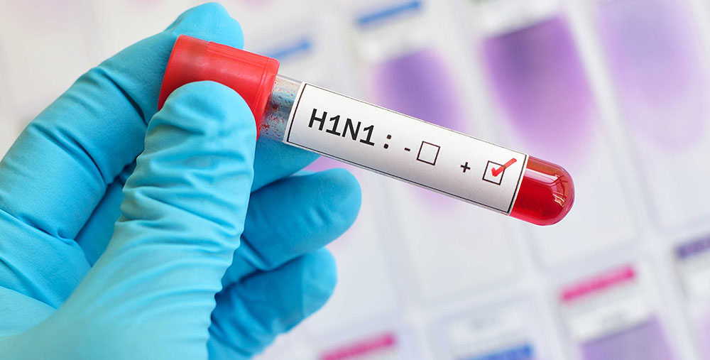 Свинячий грип найнебезпечніший - останні дослідження