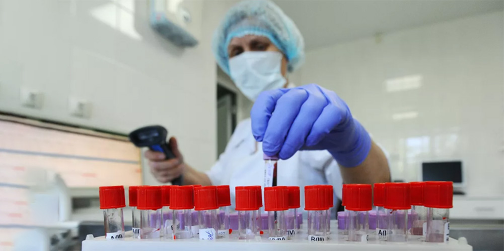 В Украине начинают исследовать препараты, которые могут бороться с коронавирусом