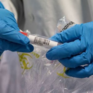 В США начинается тестирование на человеке вакцины от Сovid-19