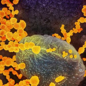 Ученые: коронавирус SARS-CoV-2 мог давно передаваться между людьми, но не вызывать пневмонии