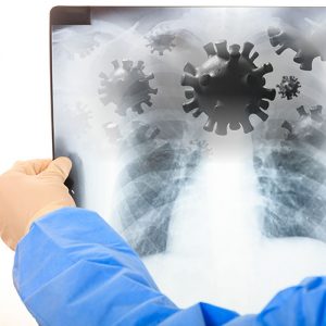 Как распознать первые симптомы вирусных инфекций дыхательных путей