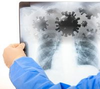 Як розпізнати перші симптоми вірусних інфекцій дихальних шляхів