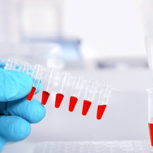 Пять биомаркеров в анализе крови помогут оценить риск тяжести COVID-19