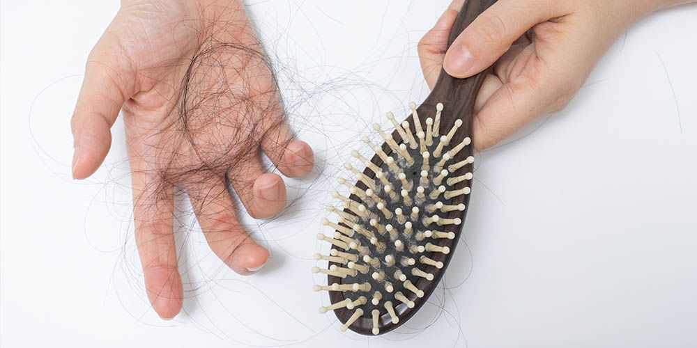 Выпадение волос – еще одно возможное последствие коронавируса