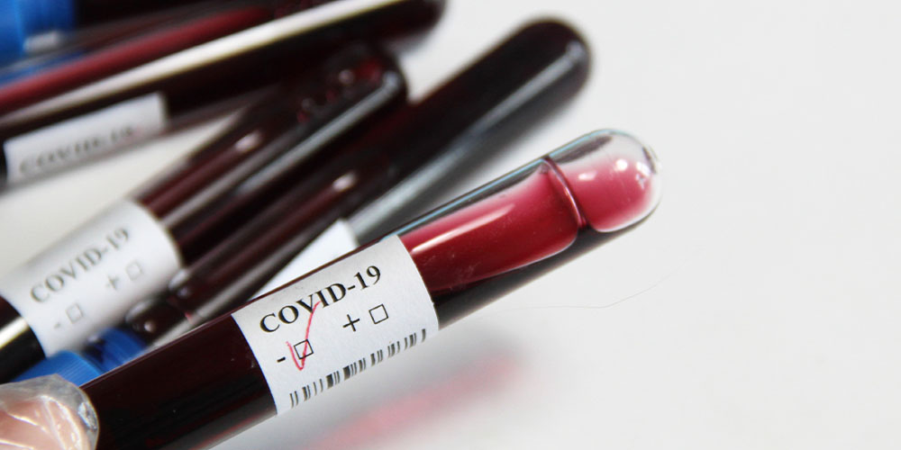 Почему у инфицированного пациента может быть негативный тест на Covid-19