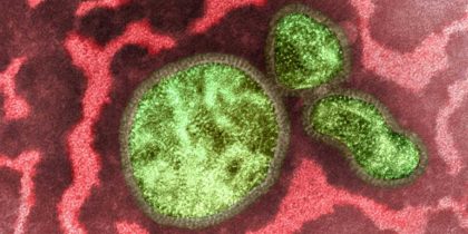 В Європі переважає циркуляція вірусу грипу типу А