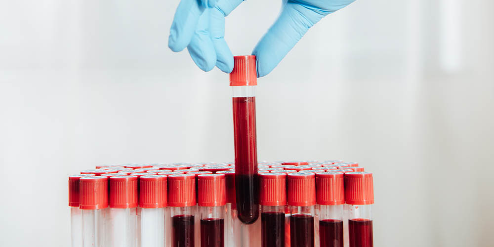Новая система проверяет тысячи образцов крови на коронавирус