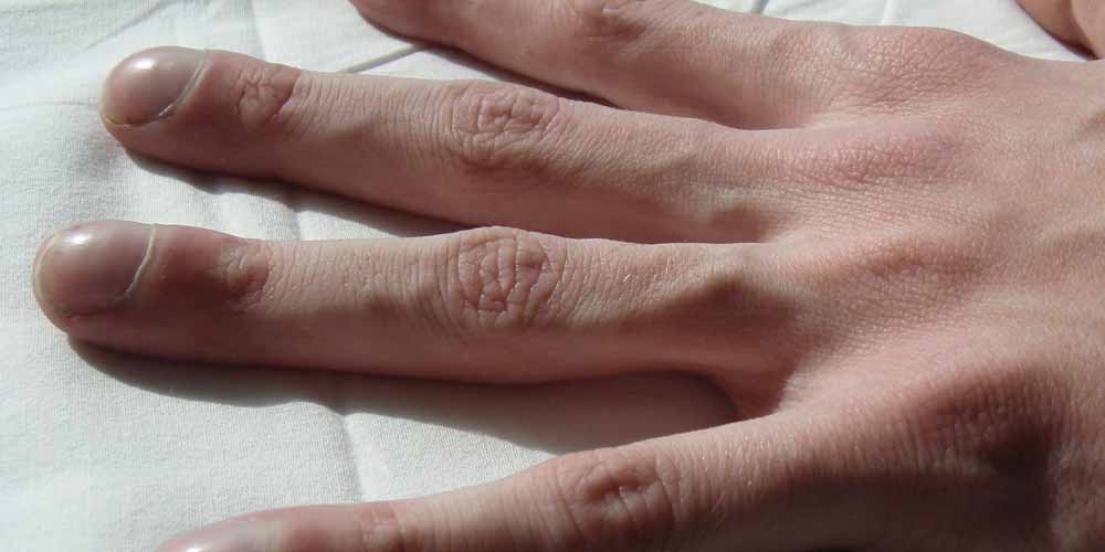 Диагностировать муковисцидоз теперь можно с помощью наклейки на коже