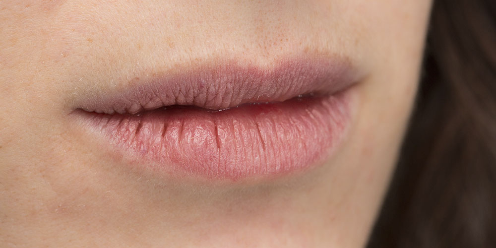 Что поможет при сухости губ