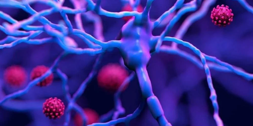 Воспаление мозга при COVID-19 похоже на болезнь Альцгеймера