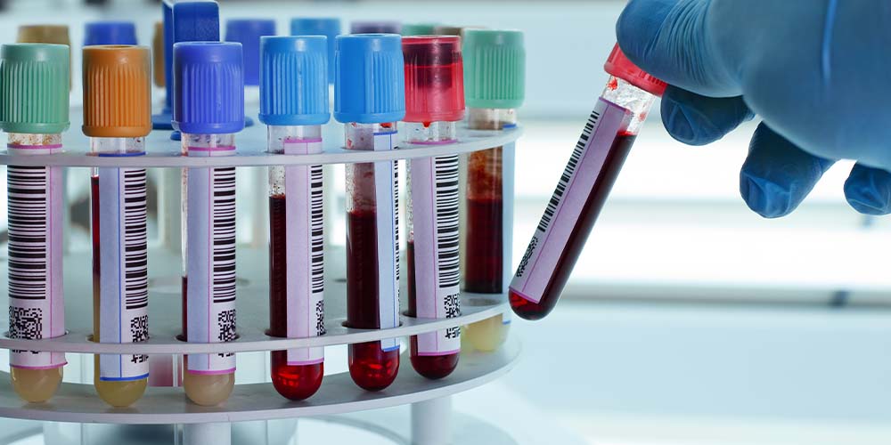 Исследователи проверили действенность разных доз разжижающих кровь препаратов при COVID-19
