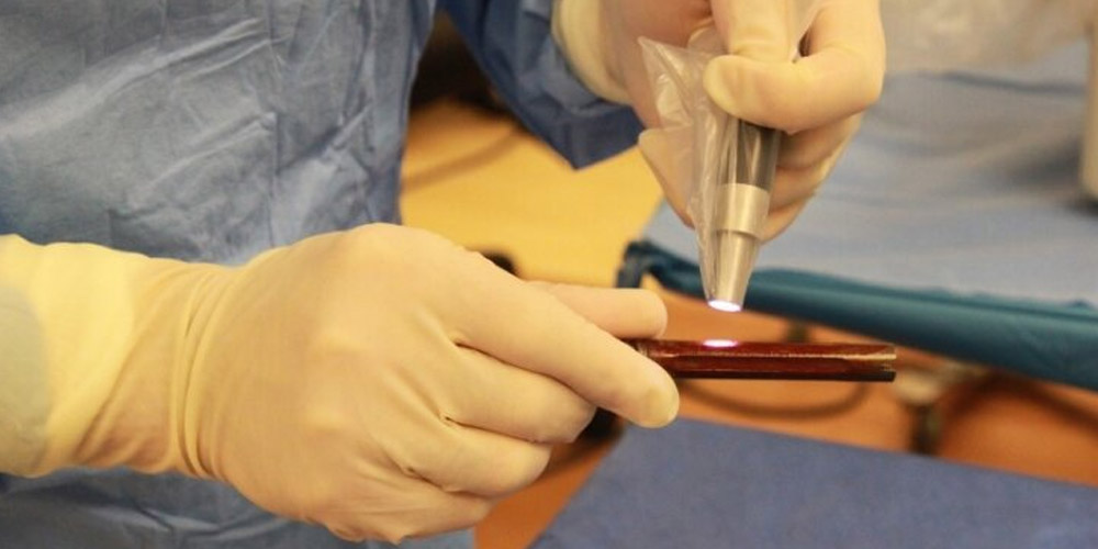 Изобрели антимикробное покрытие для ортопедических имплантатов