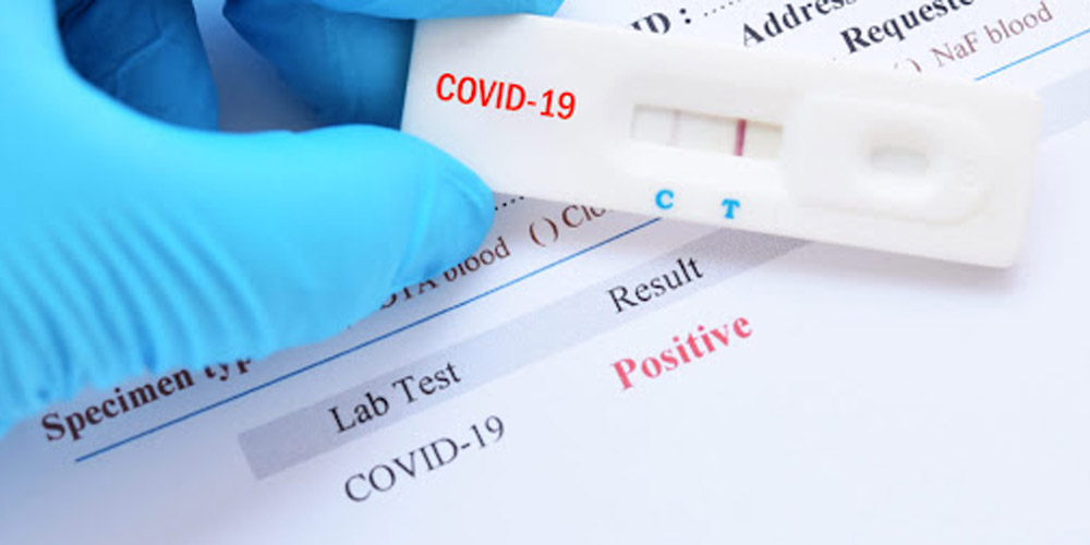 Если сдать тест на коронавирус вечером, результат может быть ложным