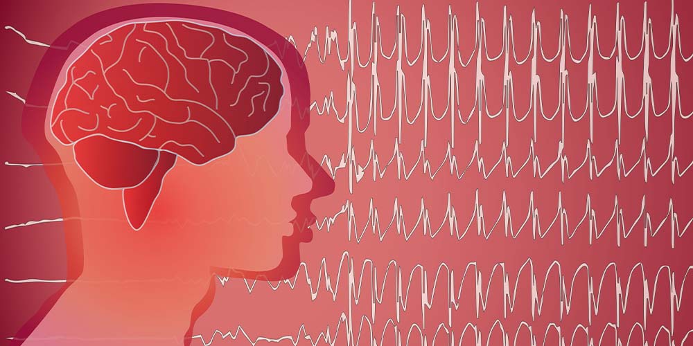 С помощью спецустройства люди с эпилепсией могут прогнозировать приступы