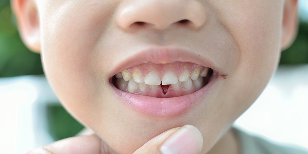 Молочные зубы расскажут о психическом состоянии малышей