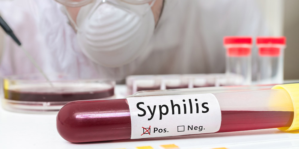 Ученые заявляют о возрождении сифилиса