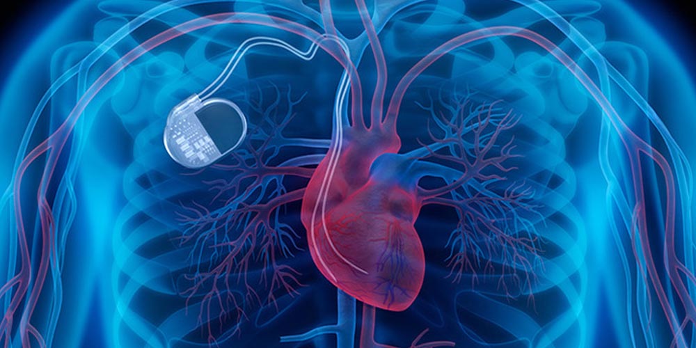 Революционный кардиостимулятор может изменить лечение сердечной недостаточности