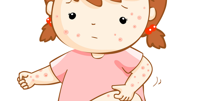 На шкірі у дитини висип: на що звернути увагу